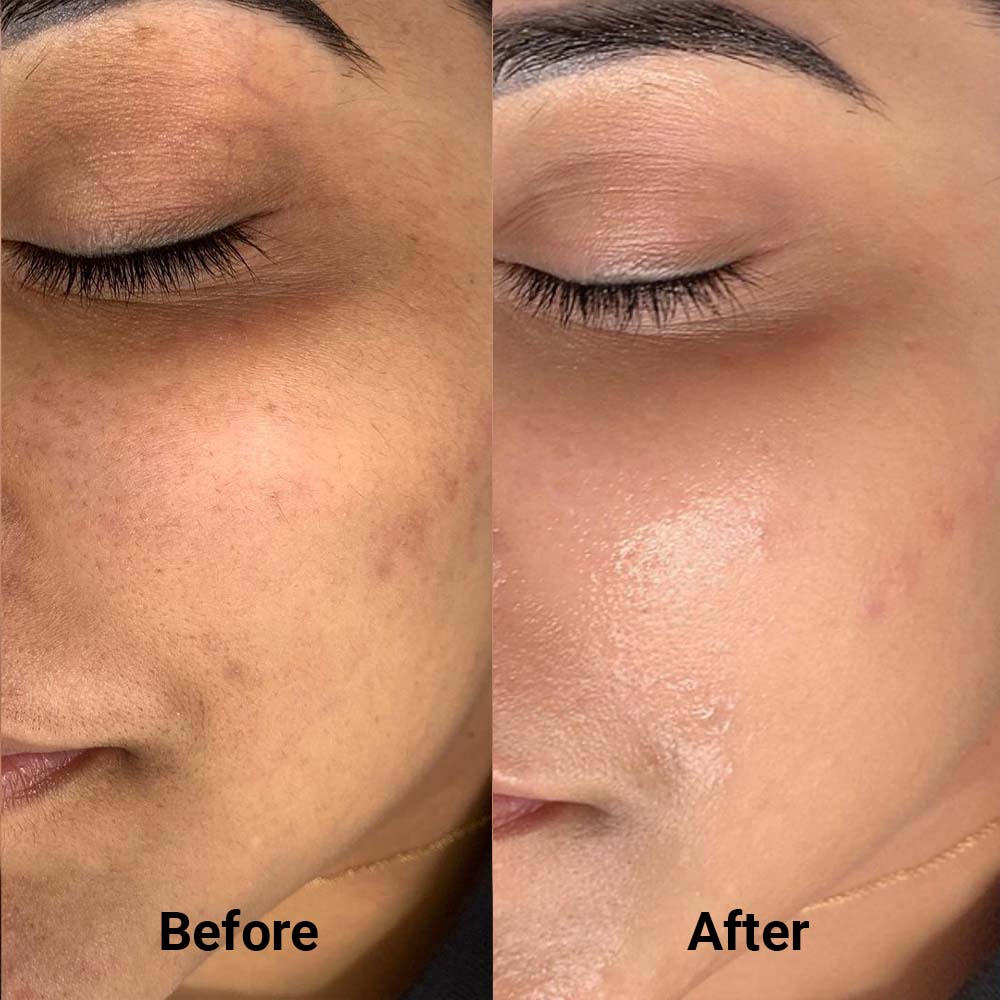 Before and after treatment